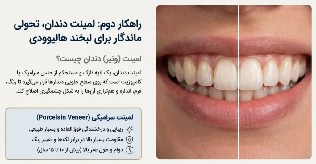 لمینت دندان یا باندینگ؟ کدام برای لبخند شما بهتر است؟